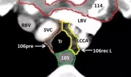 肺下界移动度叩诊视频,肺下界移动度叩诊技巧解析