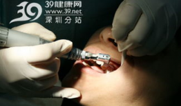 洗牙视频全过程,从准备到结束的全方位体验