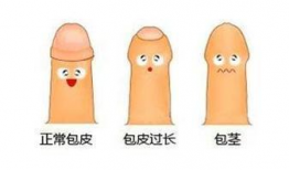 割包皮视频,专业视频解析